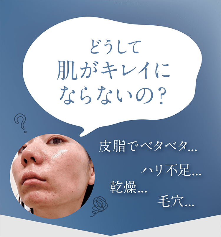 肌トラブルの悩み。皮脂・乾燥・毛穴・ハリ不足などで肌がきれいにならない原因とは