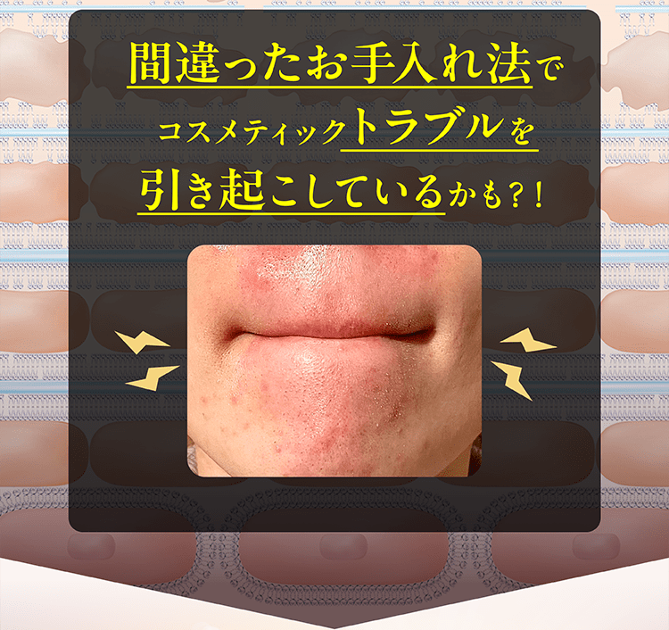 間違ったスキンケアが肌トラブルを引き起こす原因になる可能性